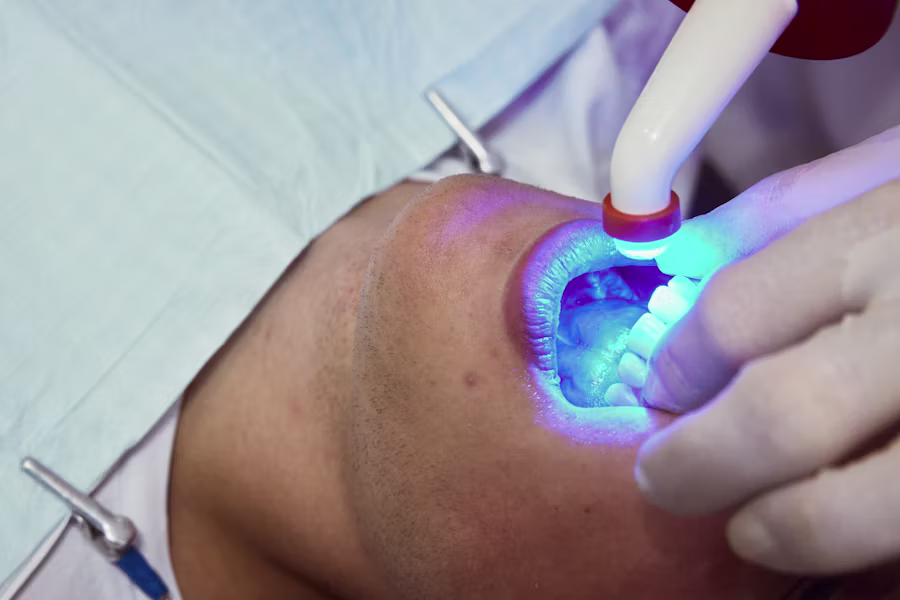 Sbiancamento denti professionale in studio — Studio Dentistico Personeni