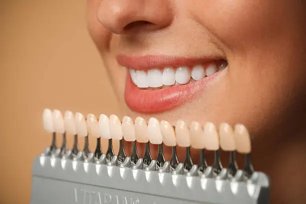 Sorriso sano e sereno — Studio Dentistico Personeni a Bergamo